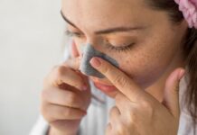 Μαύρα στίγματα: Πώς αντιμετωπίζονται αποτελεσματικά;